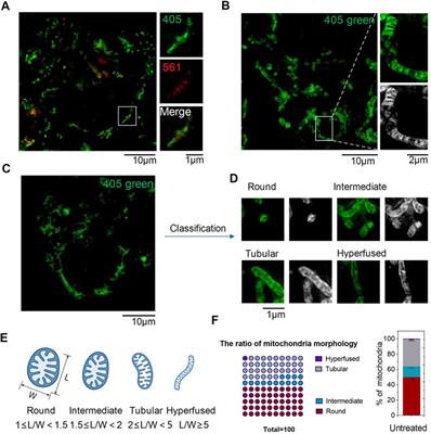 A Dual-Labeling Probe for Super-Resolution Imaging to Detect Mitochondrial Reactive Sulfur Species in Live Cells